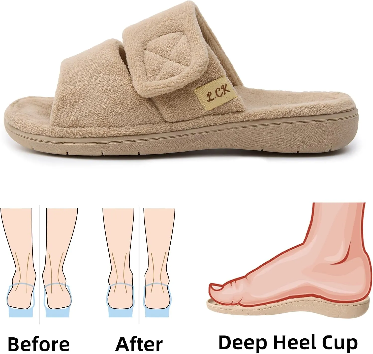 Women's Fuzzy Adjustable Arch Support Slippers Open Toe House Shoes for Orthopedic Plantar Furry House Slide Slippers All Season Beige Black Color US6-US11